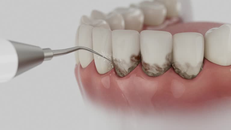Trusted Root Canal Treatment service in Ruston, LA - Dentist Open Now